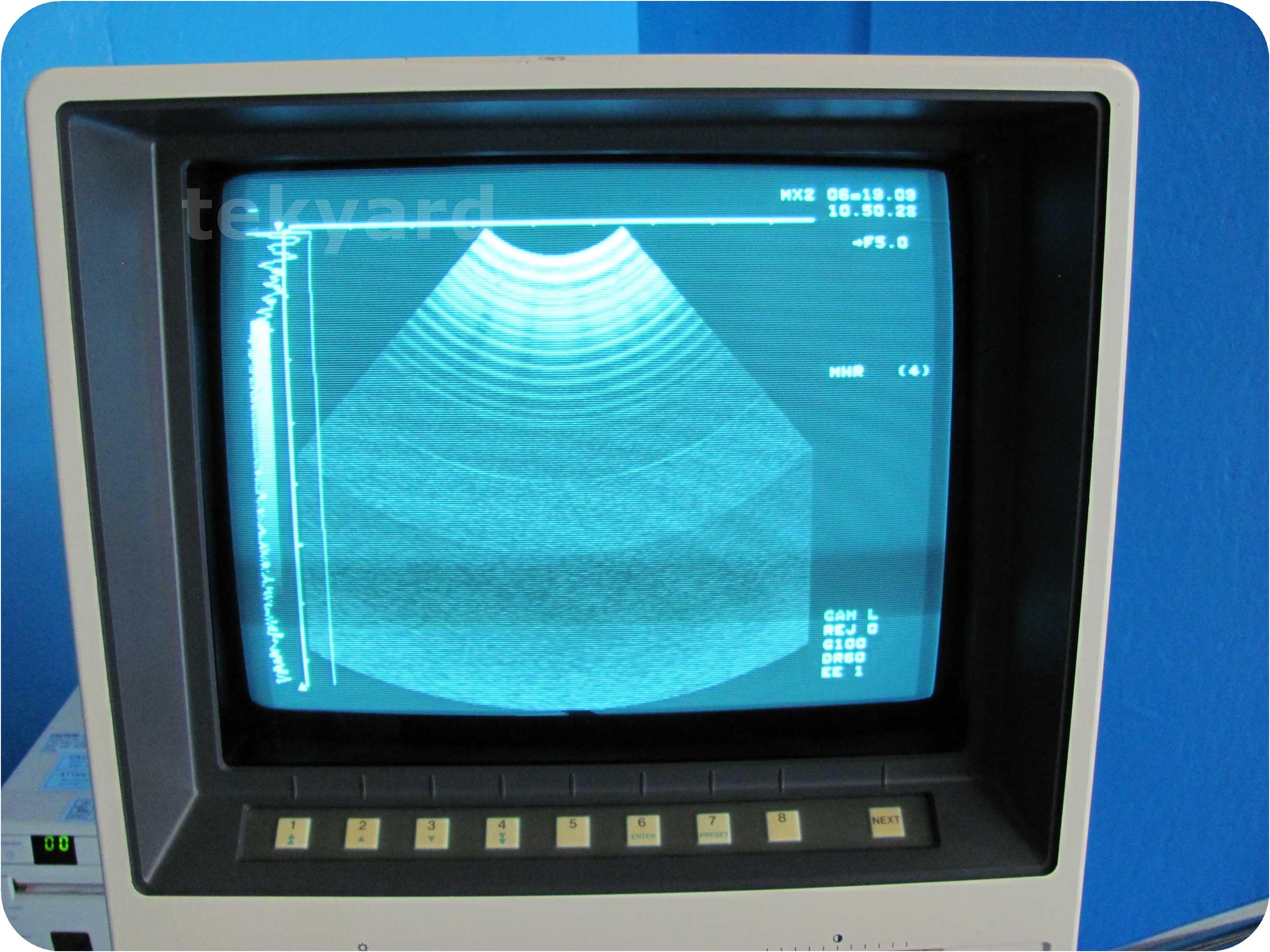 tekyard, LLC. - 72545-Toshiba Corporation Sonolayer-L SAL-77B