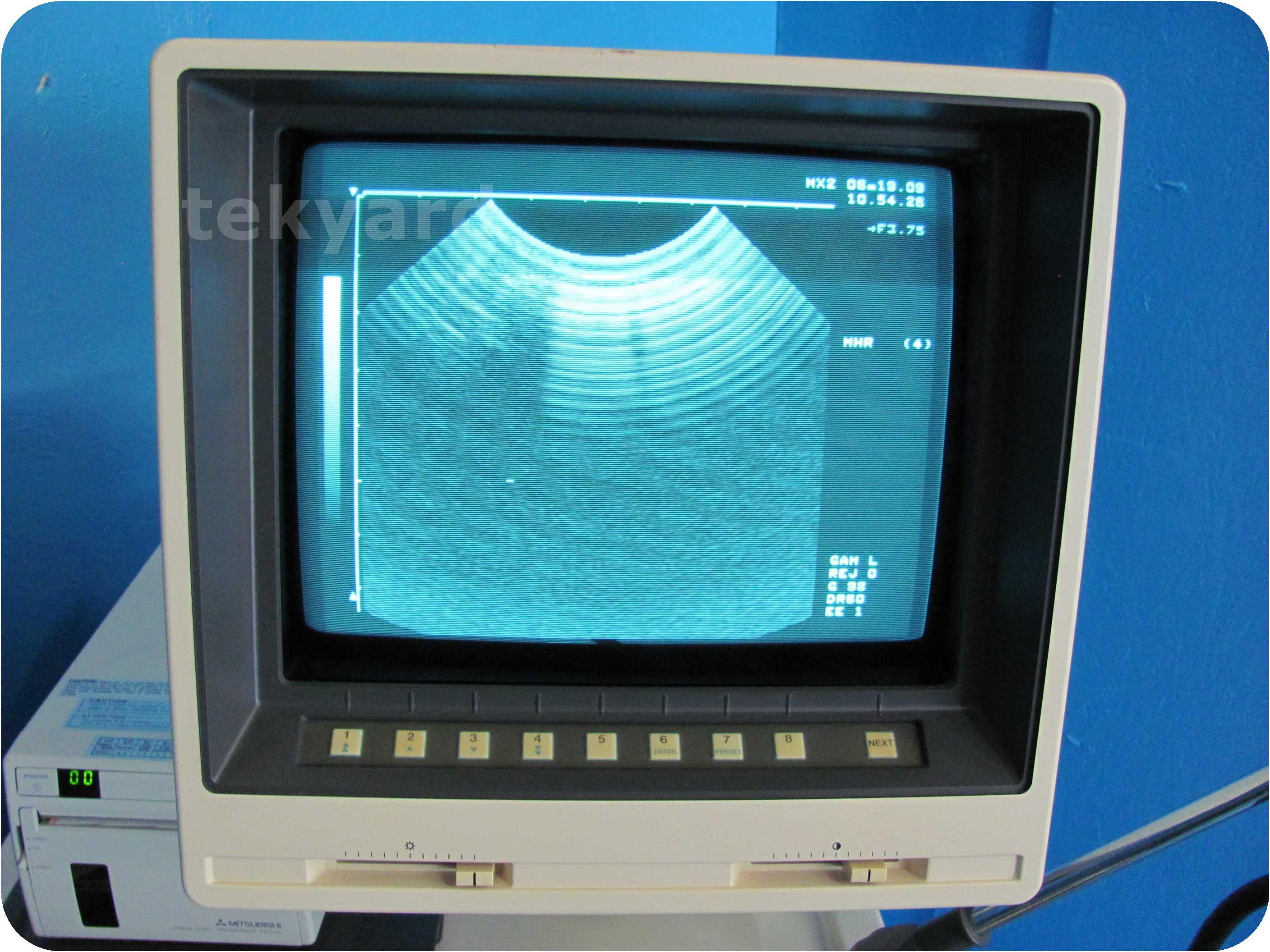 東芝　Sonolayerα SSA-250A Toshiba Sonolayer SSA-250A Ultrasound Machine PVF-375MT 575MT Probes