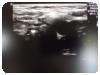 -1-274165-item-7b776a03-72442-20210617041427581